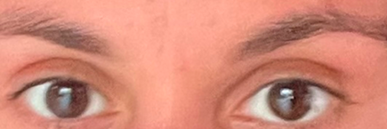 eyes