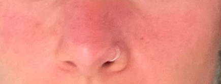 nose